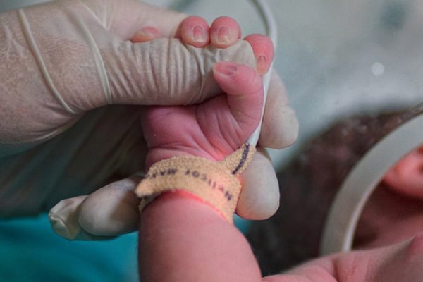 terapia-intensiva-neonat